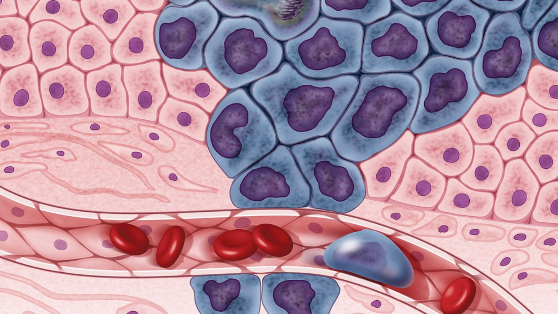 A new AI tool draws better boundaries around cancer cells and flags its own mistakes